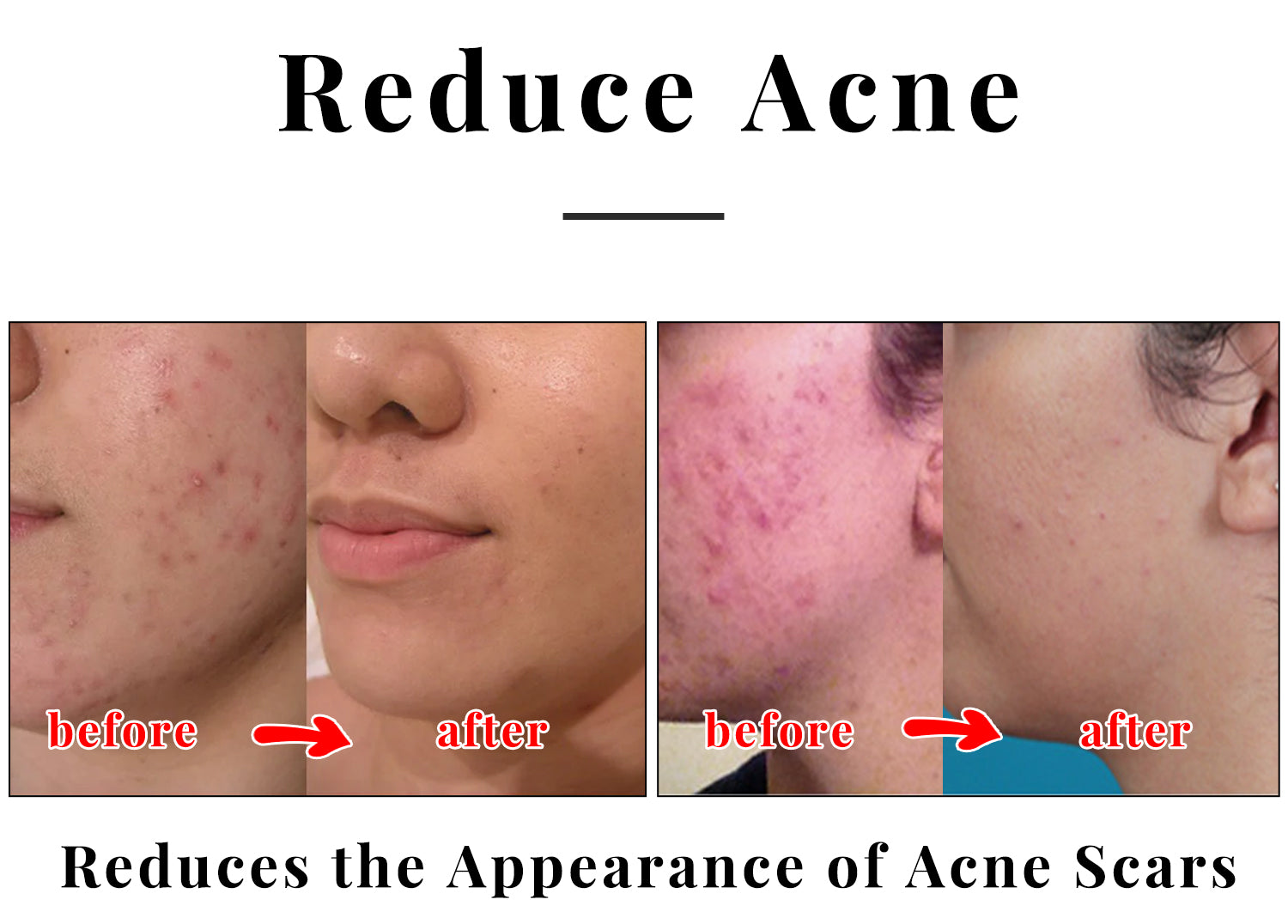 Kojic Acid Soap – 2 Pack