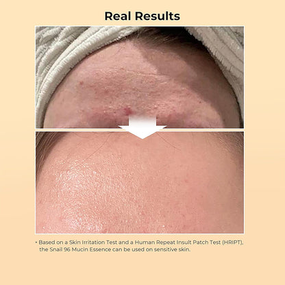 Snail Mucin Serum