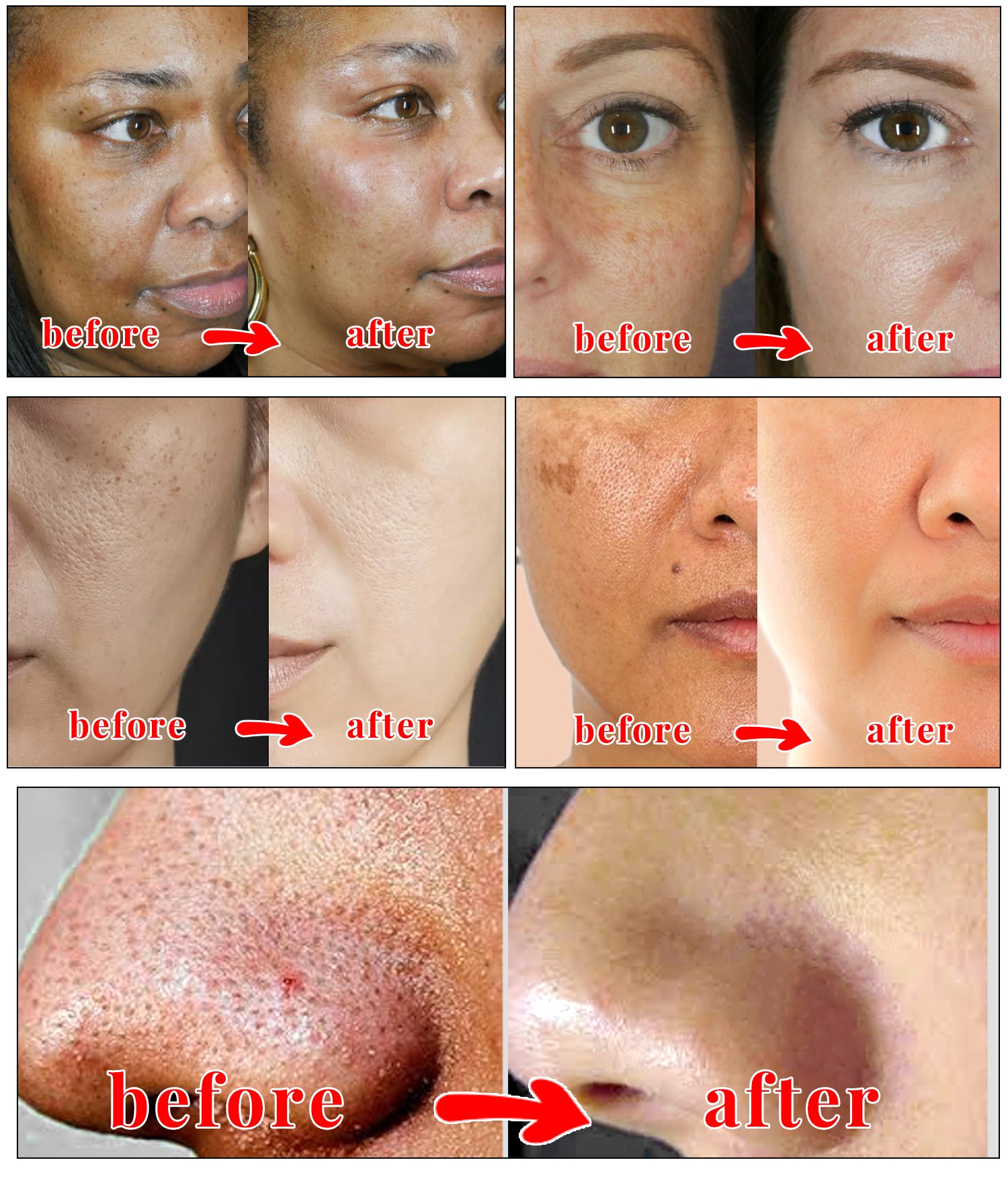 Kojic Acid Soap – 2 Pack