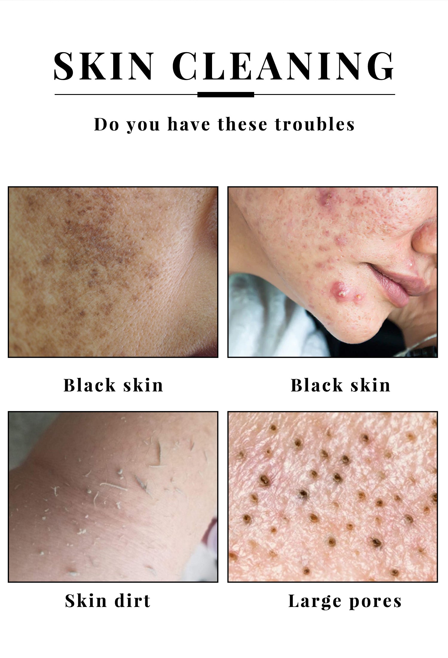 Kojic Acid Soap – 2 Pack