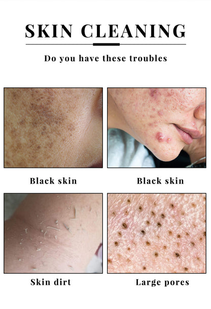 Kojic Acid Soap – 2 Pack