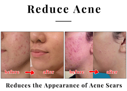 Kojic Acid Soap – 2 Pack